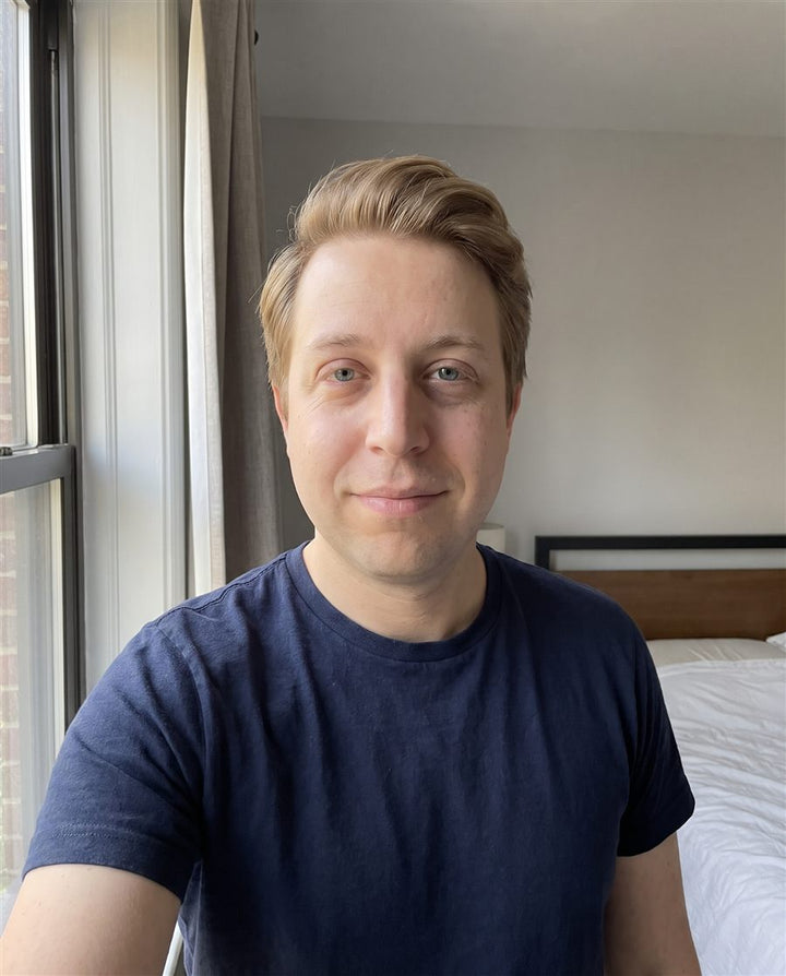 After: a man's face, front view