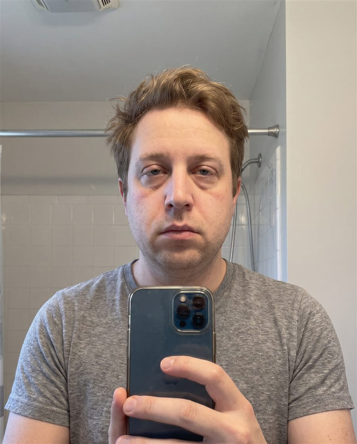 Before: a man's face, front view