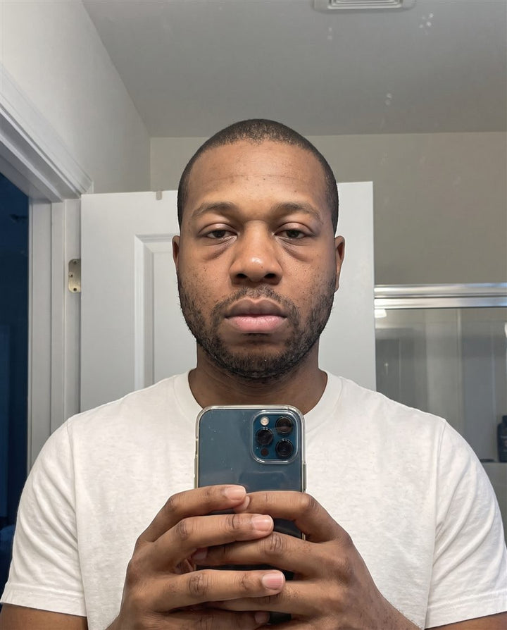 Before: a man with a beard, front view
