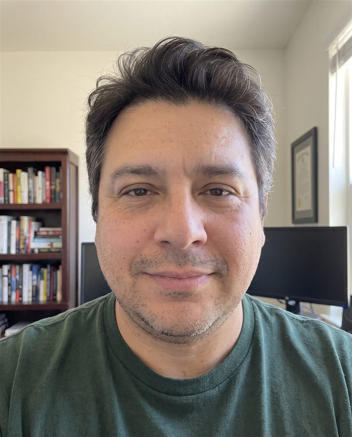 After: a man's face, front view