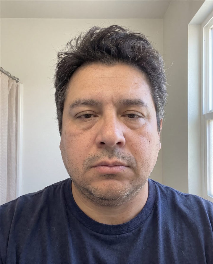 Before: a man's face, front view