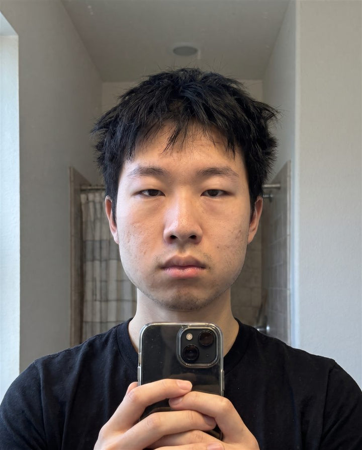 Before: a man's face, front view