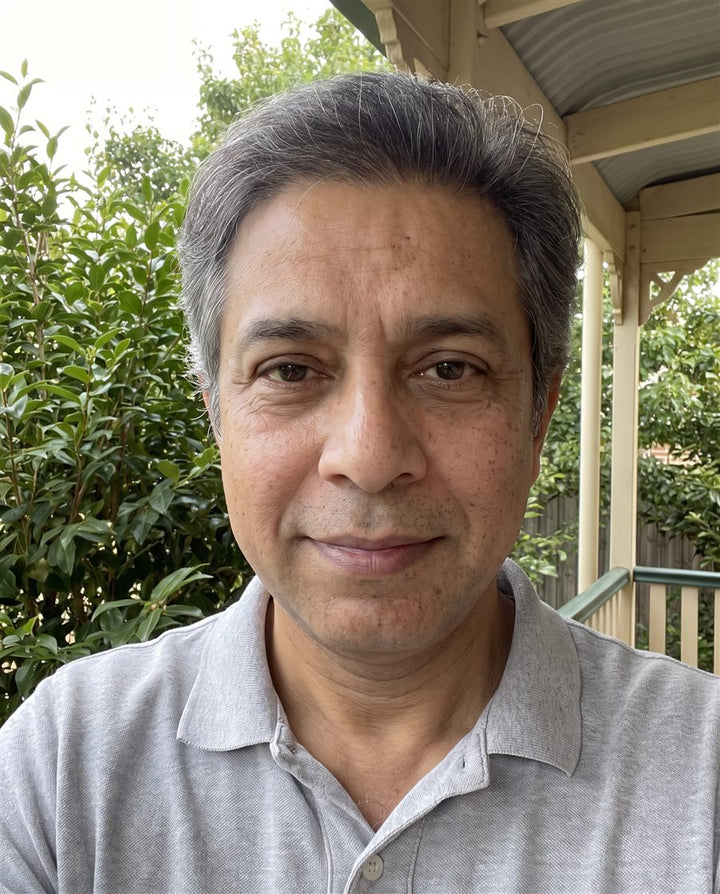 After: the same man with smaller bags under his eyes