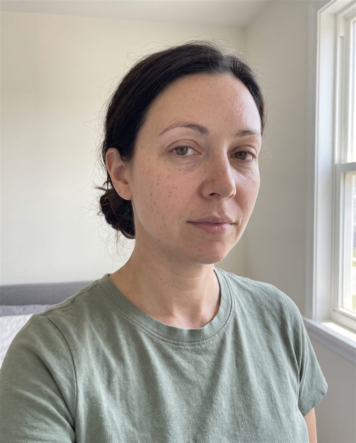 After: a woman's face, front view