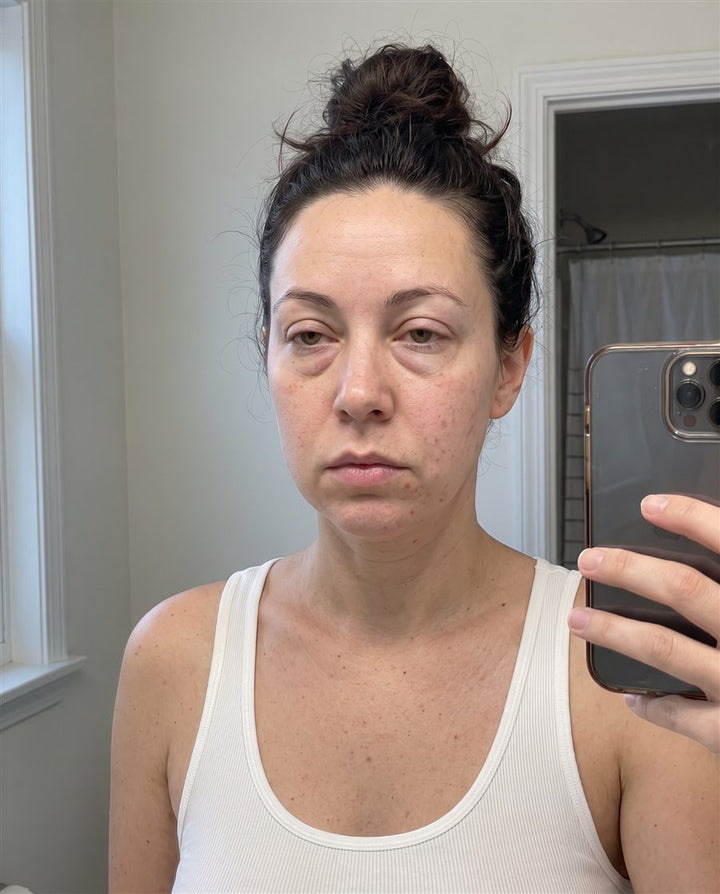 Before: a woman's face, front view