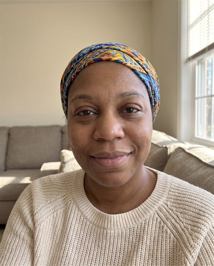 After: the same woman three weeks later, less swollen under the eyes and around the cheeks