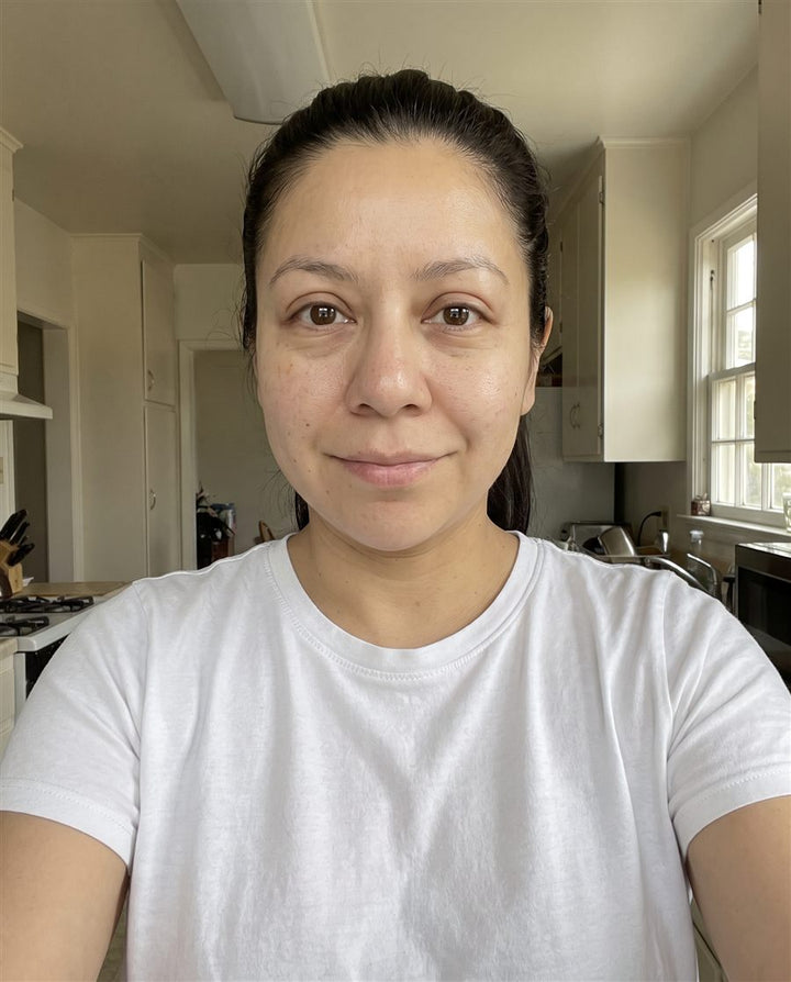 After: a woman's face, front view