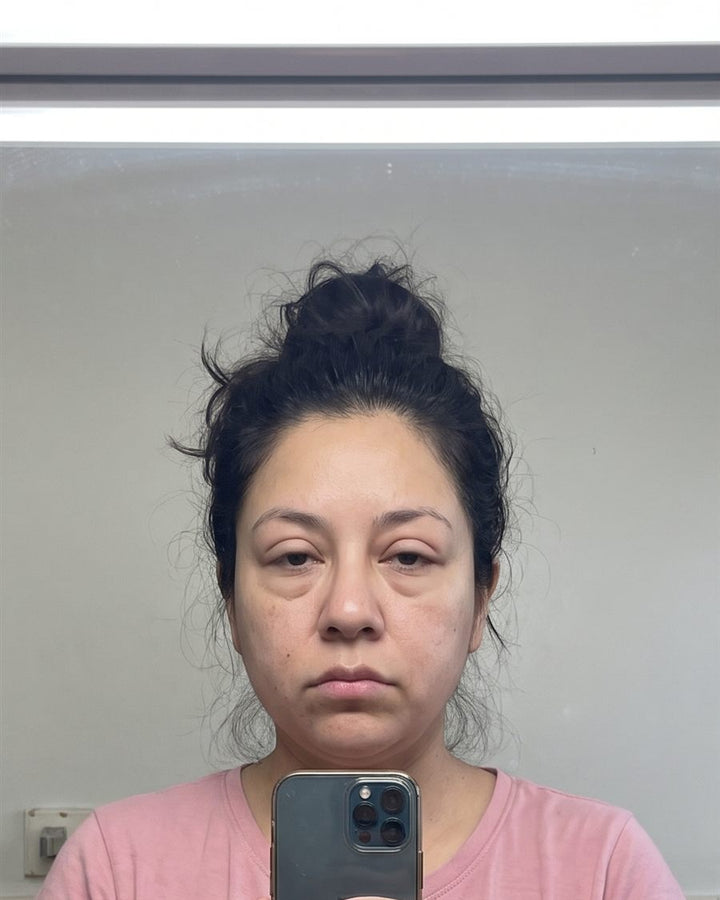 Before: a woman's face, front view