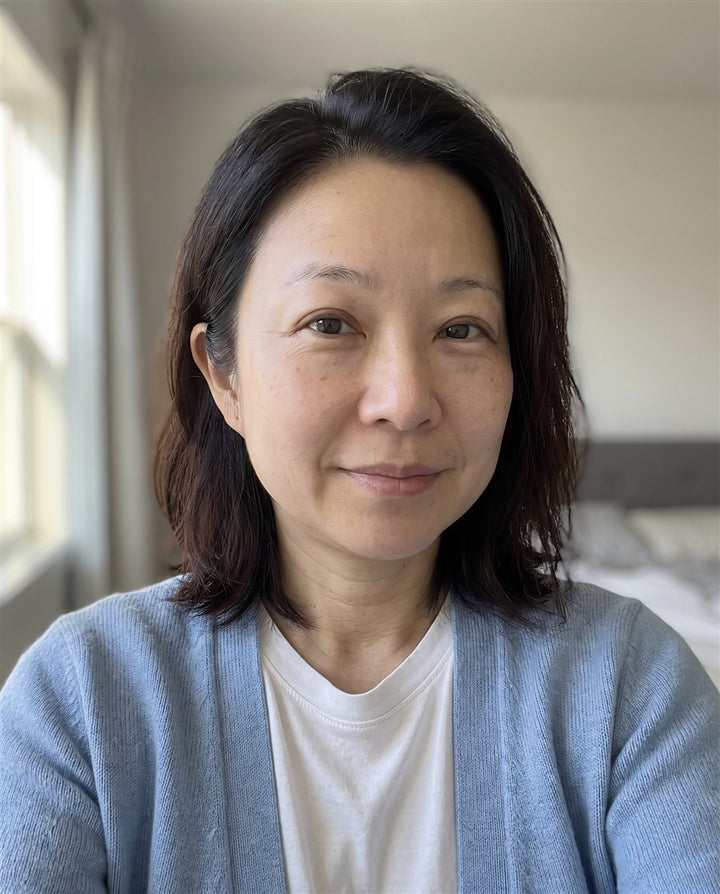 After: the same woman with less puffy eyelids