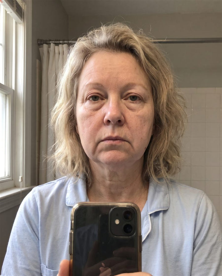 Before: a woman's face, front view
